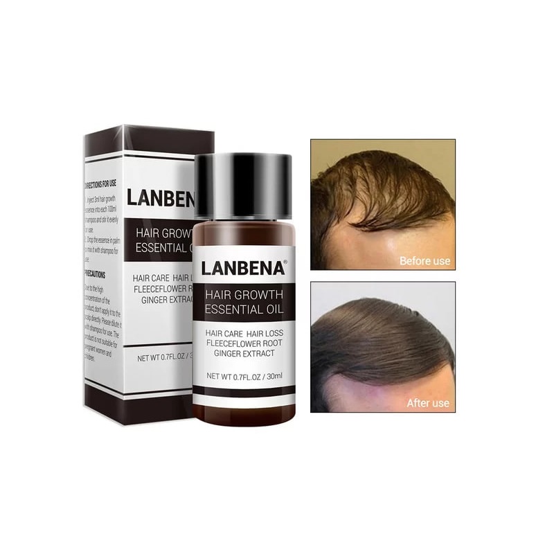 روغن رشد مو و ریش لانبنا LANBENA